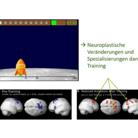 Grafari - Mental number line training in children with developmental dyscalculia